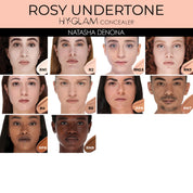 RN1 - Fair Rosy Neutral
