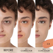 C3 - Medium Corrector